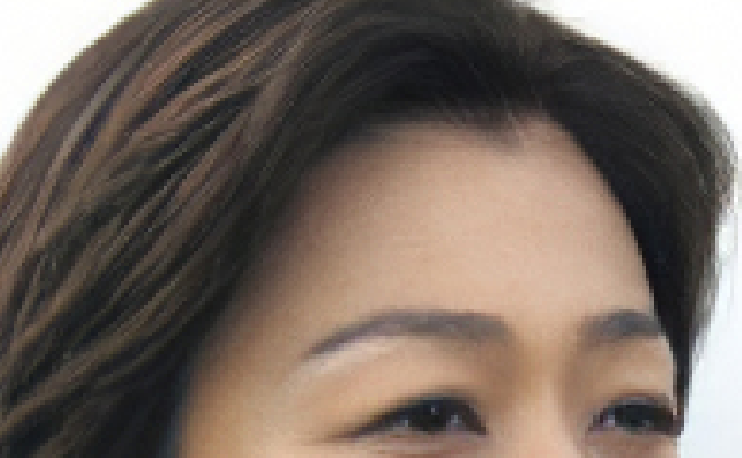 自然な生え際のメリット